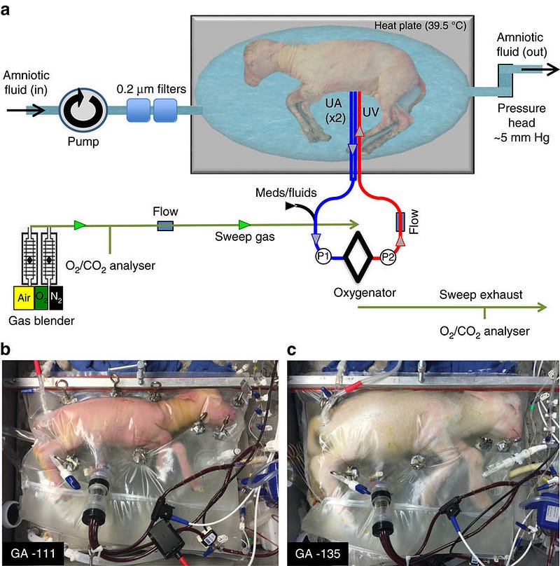 Artificial womb technology